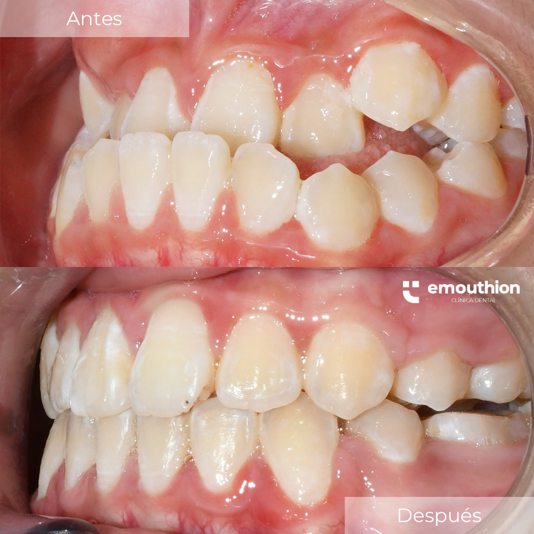 tratamiento ortopedia + ortodoncia, dentista, especialista, lima